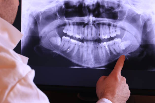 Best Same-Day Emergency Dentist in Nicholasville, KY