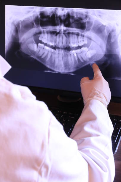 Best Emergency Tooth Extraction in Nicholasville, KY