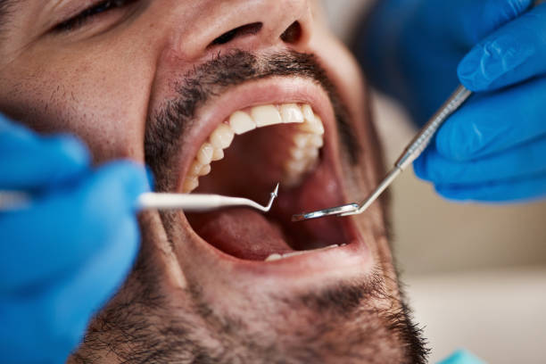 Best Emergency Treatment for Toothache in Nicholasville, KY